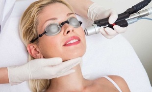 How is the laser facial skin rejuvenation procedure performed