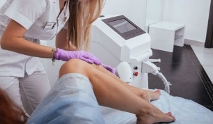 laser removal of unwanted body hair