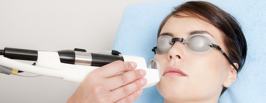 Rejuvenation with facial skin field laser