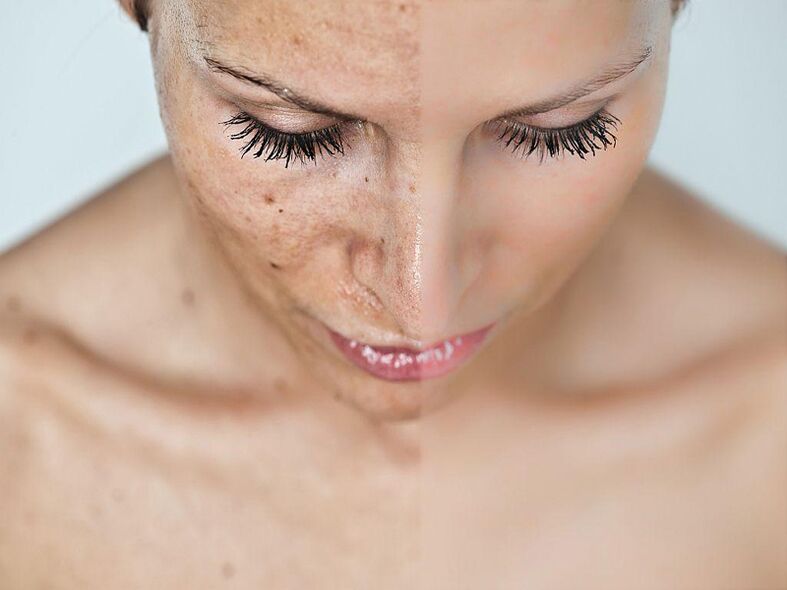 Face before and after procedures