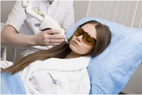 Fractional laser resurfacing