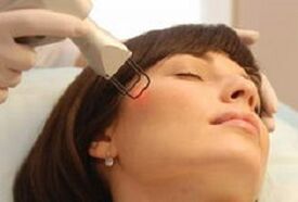 the essence of the laser fractional facial skin rejuvenation procedure